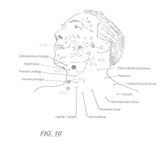 Vitalstim Electrode Placement 4b Keyword Data Related