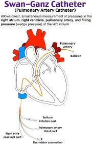 Rosh Review Icu Nursing Cath Lab Nursing Critical Care Nursing