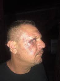 Denizlispor Başkanı Ali Çetin oğullarıyla birlikte darp edilip gözaltına  alındı