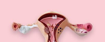 During or after running, walking or other … during or after running, walking or other … read more Who Decides Who Gets A Hysterectomy Teen Vogue