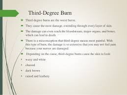 Image result for Toddler dies after suffering third-degree burns