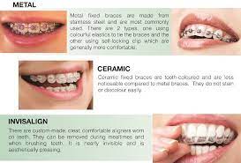 What Should I Do After Getting My Braces Off Braces Braces Off Braces Colors