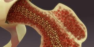 Laboratory hematology > normal and reactive bone marow. Bone Marrow Stem Cell Transplantation My Health Turkey