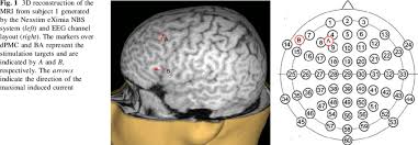 Nexstim plc announces resolutions of the shareholder's nomination board. 3d Reconstruction Of The Mri From Subject 1 Generated By The Nexstim Download Scientific Diagram