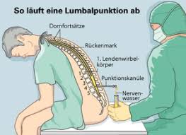 Die ursachen sind noch nicht ganz klar, aber die folgen: Multiples Sklerose Heilung Wie Ich Von Multiples Sklerose Geheilt Wurde Multiple Sklerose Sklerose Anatomie Organe