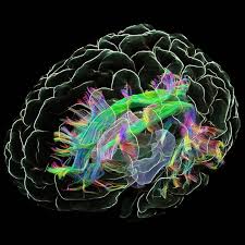 Alzheimer's & Dementia - Wiley Online ...