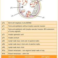 It depends on your individual condition, type of cancer, treatment and level of fitness. Pdf Testicular Cancer An Overview Of Contemporary Practice