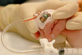 Image result for Difficult Intravenous Access in Children
