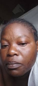 Any tips to get rid of dark spots around mouth?