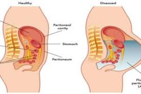 Image result for Fluid Wave Test