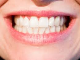 I cant take a picture of my teeth but on my bottom teeth theres one tooth sticking out and all the rest sticking in, and on the top how do i know if i need braces? Do I Need Braces Identifying Common Signs And Symptoms