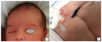 Image result for Harlequin Color Change