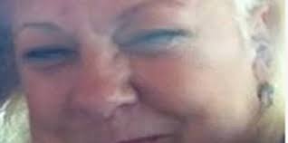 Fund set up to help Sparta woman burned in fire