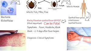 Image result for Rickettsiae