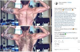 Also you can list latest follows, videos and images by. Inspiring Scoliosis Instagram Accounts My Top 10 Life With Scoliosis