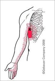 Pin On Fibromyalgia Costochondritis I Love You Back To Love