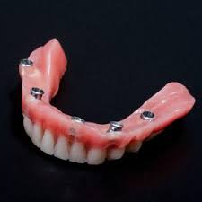 Feb 23, 2021 · dentures aren't, however, perfect, and if you have dentures, you might be aware that after a while, they don't always fit as securely as they should. High End Dentures And How To Find Them Lincoln Family Dentistry