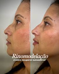 Eu vou te dar mais do que você me pediu. Seja paciente e confie em mim.”  Efésios 3:20