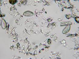 Image result for Pinworm