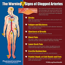 Two large arteries flow from the heart up the sides of the neck and into the brain. The Warning Signs Of Clogged Arteries