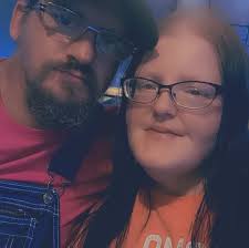 Sleeve surgery recovery: Describe your initial experience