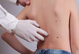 Maybe you would like to learn more about one of these? Skin Tags In Kids Causes Remedies Care