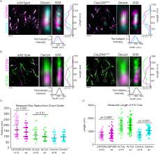 Take a sneak peak at the movies coming out this week (8/12) simone biles is mental health #goals Superresolution Microscopy Reveals Photoreceptor Specific Subciliary Location And Function Of Cep290 Biorxiv
