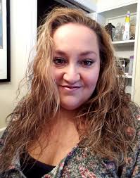 Embracing hair loss with confidence