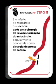 O miocárdio é o músculo do coração responsável por estimular a distribuição do sangue pelo corpo. Infarto Agudo Do Miocardio Pode Levar A Morte Hcor