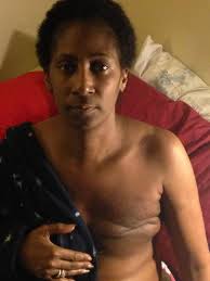 Yep...and I still wear that scar to this day🤣🤣🤣