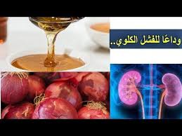 علاج الفشل الكلوي قل وداعا لغسيل الكلى مجربة وفعالة 100 Youtube Vegetables Healthy Living Healthy