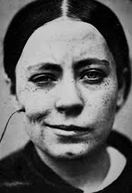 Ada Morrison: The Woman Who Escaped an Asylum for Being Too Intelligent ...