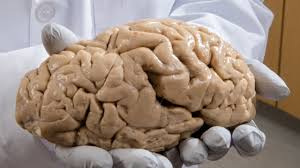 Studies of people with schizophrenia have shown there are subtle differences in the structure of their brains. Genomic Data From 2000 Human Brains Could Reveal Roots Of Schizophrenia Autism And Other Neurological Disorders Science Aaas