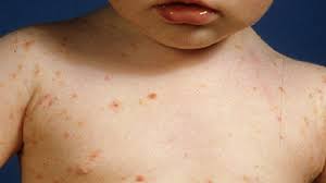 Le nom du poste, le statut, la fonction et la qualification professionnelle. La Gale