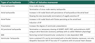 Arrhythmias And The Effect Of Valsalva Maneuver Arrhythmias