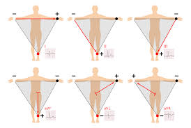 12 lead ecg placement guide with illustrations