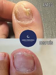 Image result for Tinnea vesiculosa