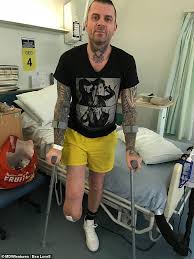 I will be out of the hospital and back home soon. Man Who Lost Half His Leg Says Doctors Have Refused To Save His Stump Daily Mail Online