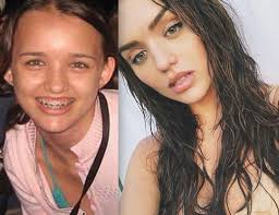 Ele e o mc kevinho ficaram famosos por suas músicas. Rafa Kalimann Choca Internautas Com Nova Foto De Antes Da Fama Aleluia Arrepiei