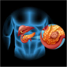 But just because some symptoms are more well known, doesn't mean. Why Pancreatic Cancer Is So Deadly Whnt Com