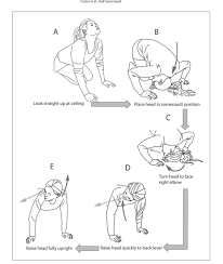 Inner ear balance home exercises to treat dizziness this video demonstrates 10 exercises that can be performed at home in order to challenge and slowly strengthen the inner ear balance system in order to treat dizziness due to vestibular dysfunction. Home Treatment Of Bppv