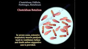 Dormant cells are highly resistant to heat, desiccation, and toxic chemicals and detergents. Clostridium Difficle Perfringes Botulinum Everything You Need To Know Dr Nabil Ebraheim Youtube