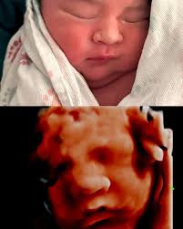 Wonder Baby 3D/4D Ultrasound