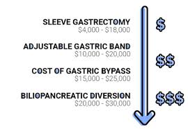 What tests do i need before surgery? Bariatric Surgery Costs Insurance 2020 In Depth Guide Graphs