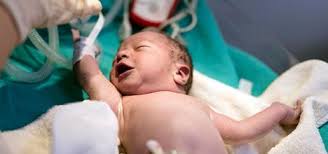 Image result for Newborn Screen