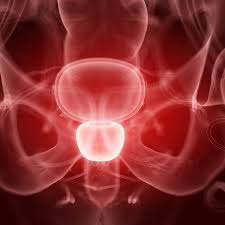 07.03.2018 · the problem is that when these types of cancer are diagnosed early it's impossible to tell the potentially harmful ones from the harmless ones. Prostate Cancer Deaths To Decline Almost Everywhere In The Eu Healthcare In Europe Com