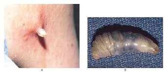 Image result for Myiasis