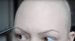 Penso che sia tutto soggettivo, ho infatti compagne di percorso terapeutico la . Chemioterapia E Perdita Dei Capelli Come Salvaguardarli Blogcalvizie