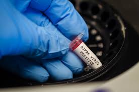 Niv symptoms and signs include vomiting, muscle aches, fever, headache. Before Nipah Alarm Spreads A Few Facts Telegraph India