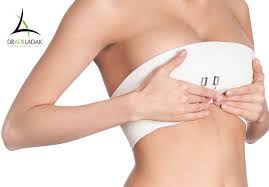 Breast Lift | Dr. Ledding Plastic Surgeon | Regina, Saskatchewan